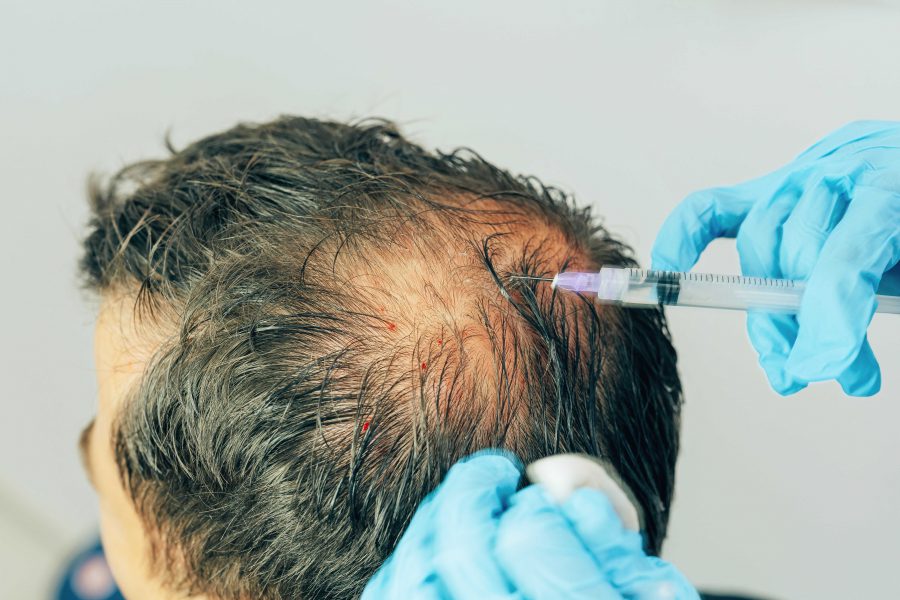 Nowości w trychologii, czyli… włos Ci z głowy nie spadnie