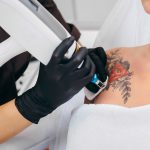Skuteczne i bezpieczne usuwanie tatuaży i makijażu permanentnego (cz. 1) – lasery i ich parametry