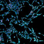Fibroblasty – główne komórki skóry właściwej (cz. 1)