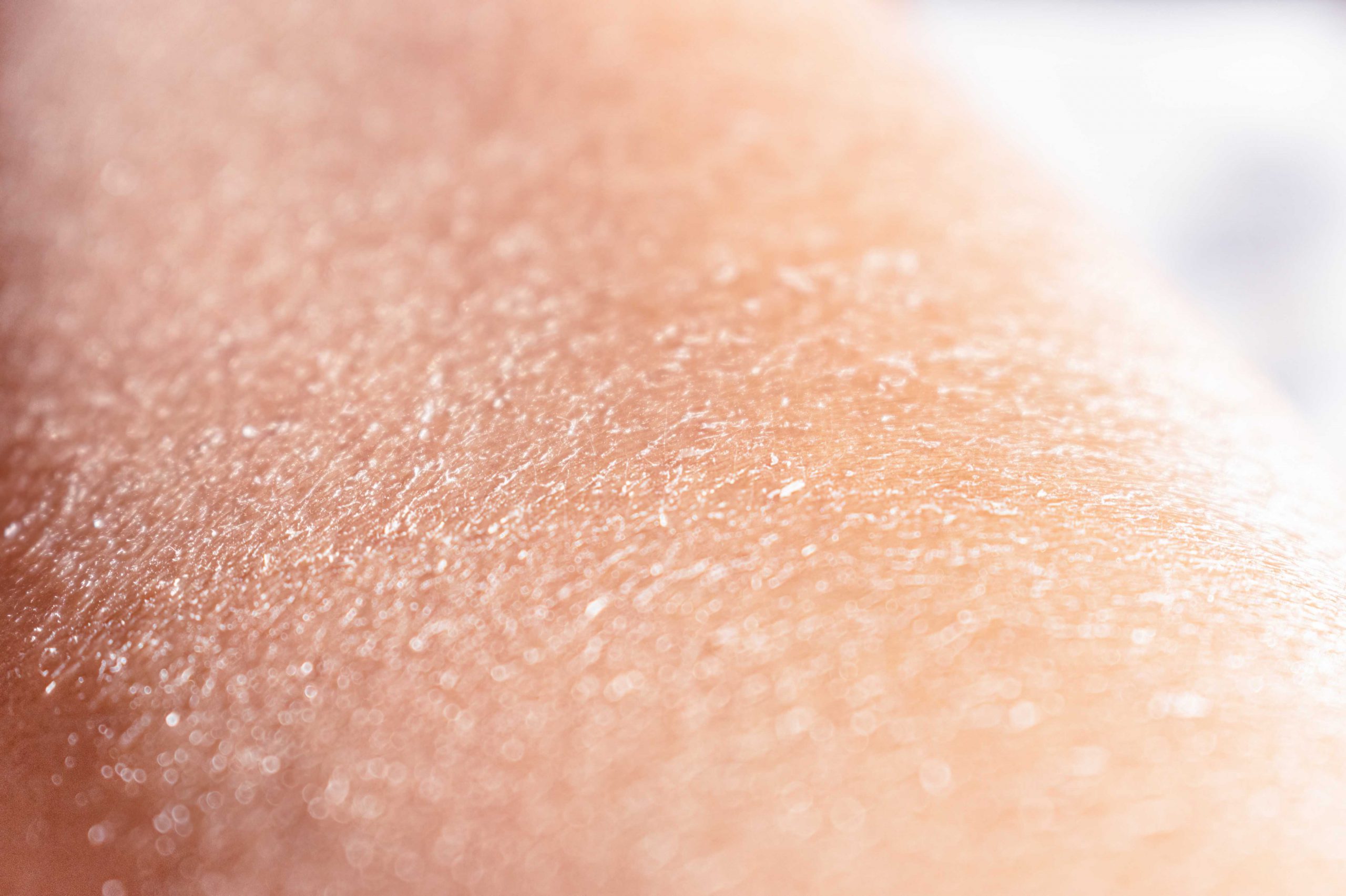Jak poradzić sobie z suchą skórą? | TOP 6 zabiegów nawilżających