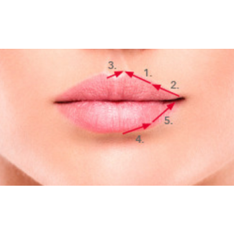 Technika Belotero Lips Contour 0,6ml